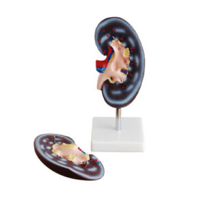 Kidney Model (2 parts), XC-310-2, ESMC, Xinch, China