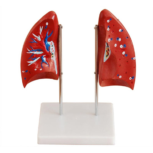 Lung Model, XC-321, ESMC, Xinch, China