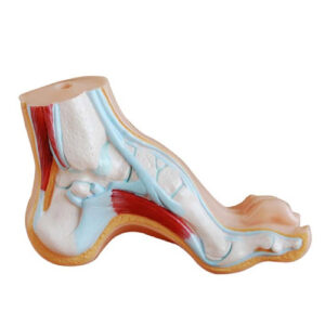 Arched Foot, XC-326-3, ESMC, Xinch, China